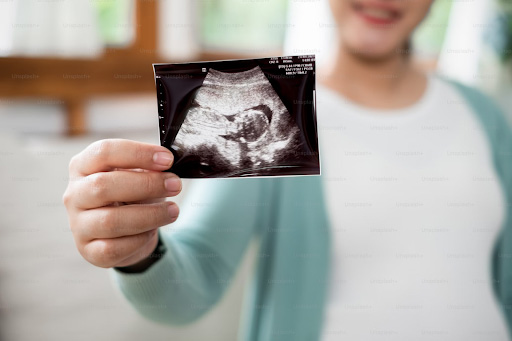 Early Pregnancy Ultrasound: What to Expect at Different Weeks