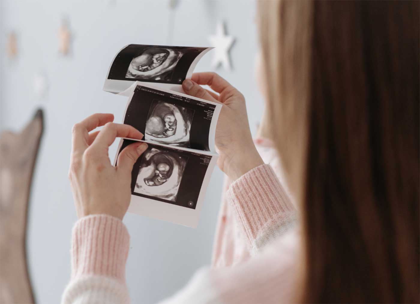 personalized 3d and 4d ultrasound experiences for mothers