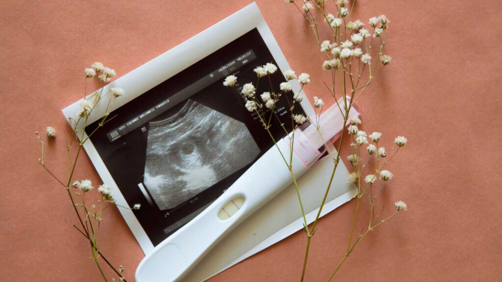 A positive pregnancy test and a sonogram photo surrounded by flowers, representing a first OBGYN checkup. 
