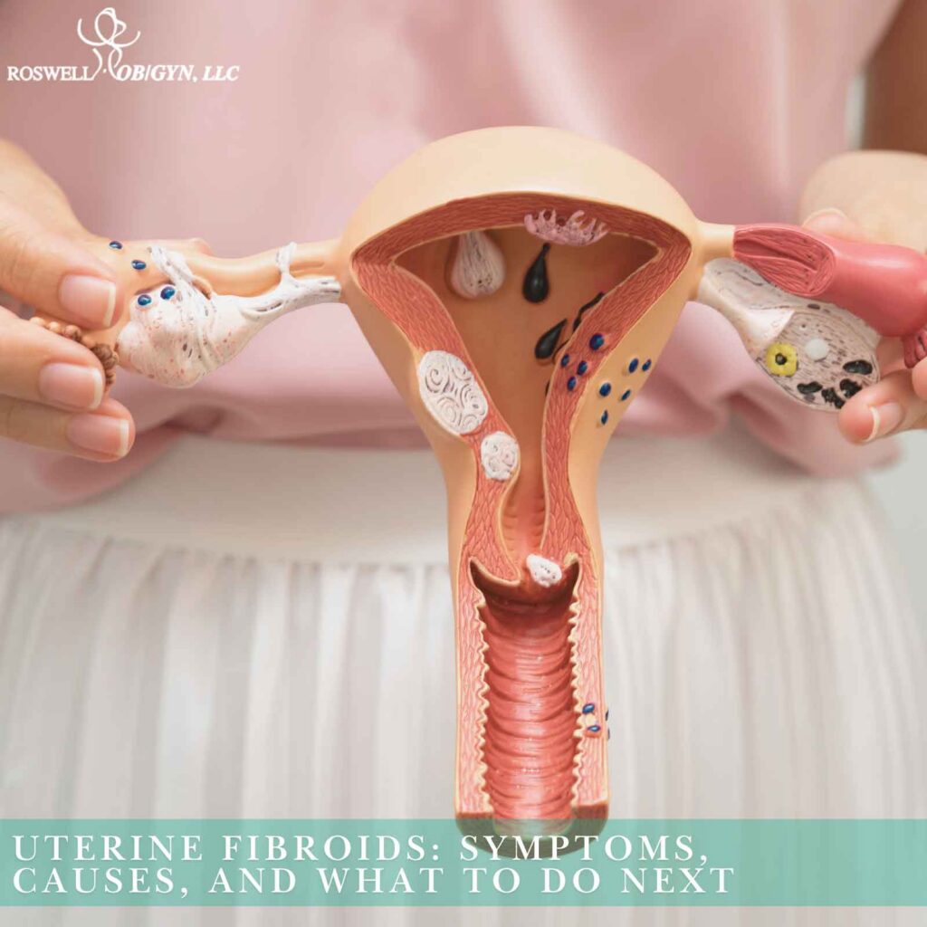 Uterine Fibroids Symptoms, Causes, and What to Do Next